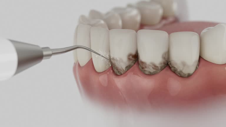 Reliable Tooth Extraction contractor in Garden Grove, CA by Smile Center Dentistry